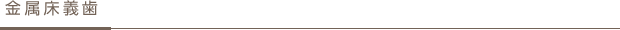 金属床義歯