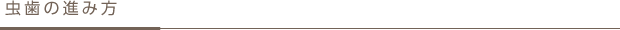虫歯の進み方